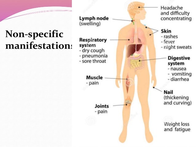 Wsparcie duchowe online dating Non specific sexually transmitted disease